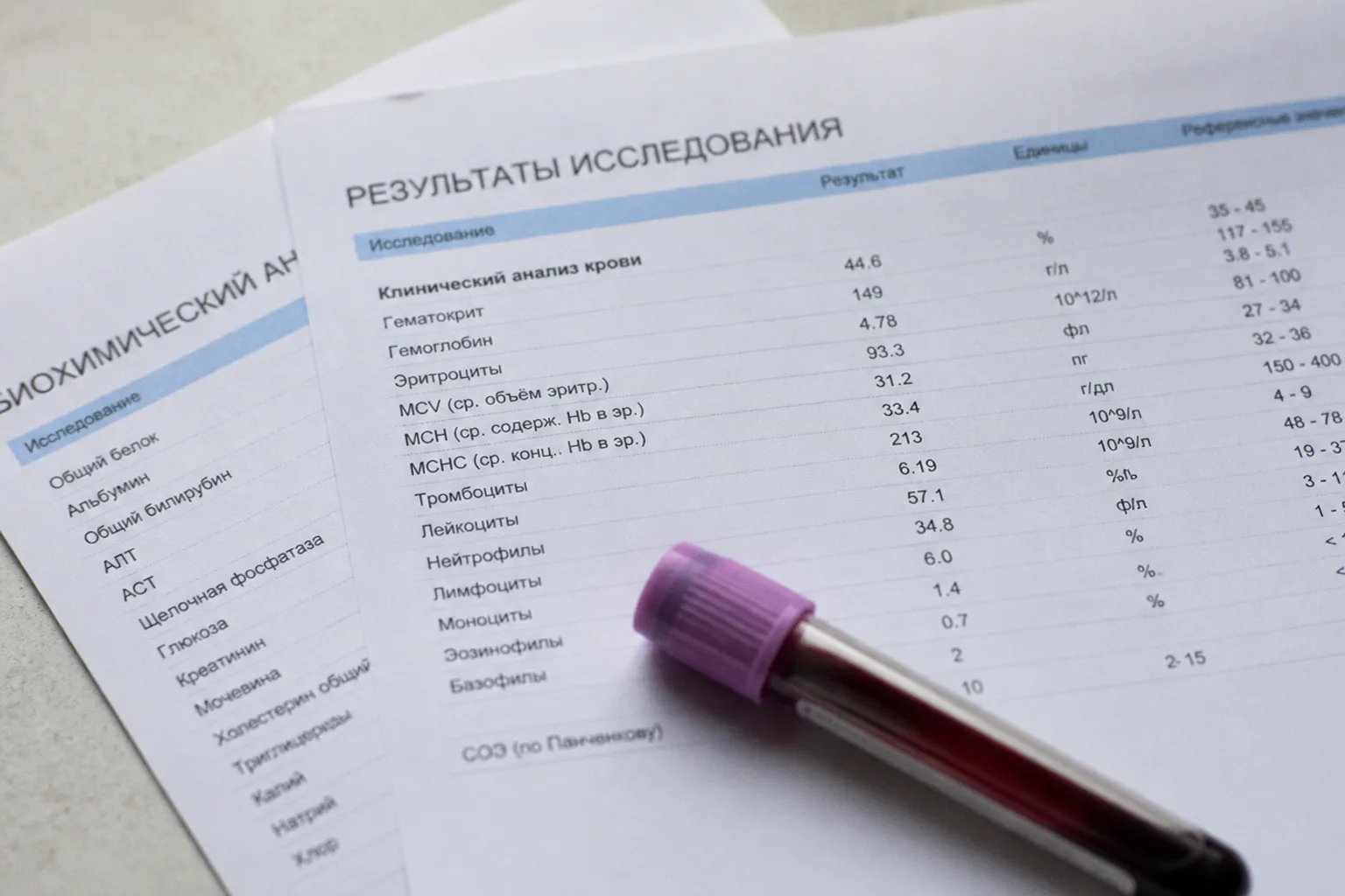 Почему онлайн-результаты анализов без расшифровки врача опасны для здоровья